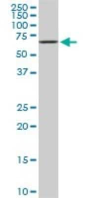 Western Blot: EPM2AIP1 Antibody (3H7) [H00009852-M01]