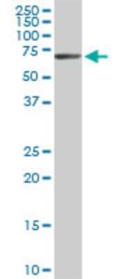 Western Blot: EPM2AIP1 Antibody (3H7) [H00009852-M01]