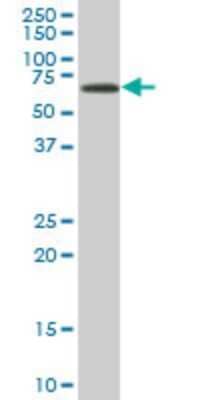 Western Blot: EPM2AIP1 Antibody (5G7) [H00009852-M02]