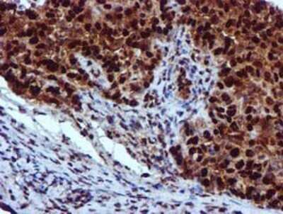 Immunohistochemistry: EPM2AIP1 Antibody (OTI2A2) - Azide and BSA Free [NBP2-71497]