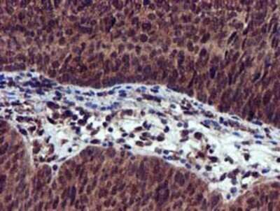 Immunohistochemistry: EPM2AIP1 Antibody (OTI2A2) - Azide and BSA Free [NBP2-71497]