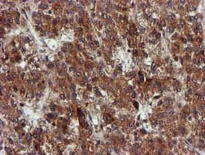 Immunohistochemistry: EPM2AIP1 Antibody (OTI2A2) - Azide and BSA Free [NBP2-71497]