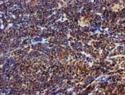 Immunohistochemistry: EPM2AIP1 Antibody (OTI2A2) - Azide and BSA Free [NBP2-71497]