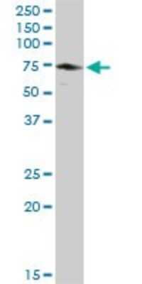 Western Blot: EPM2AIP1 Antibody [H00009852-D01P]