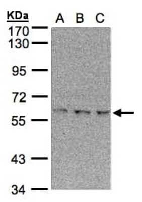 Western Blot: EPM2AIP1 Antibody [NBP1-31063]