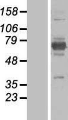 Western Blot: EPM2AIP1 Overexpression Lysate [NBL1-10296]