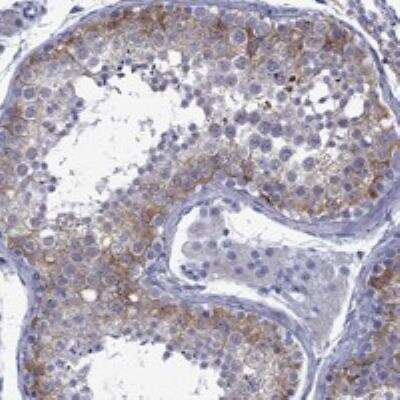 Immunohistochemistry-Paraffin: EPPIN-WFDC6 Antibody [NBP3-17970]