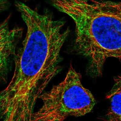 Immunocytochemistry/ Immunofluorescence: EPPK1 Antibody [NBP2-57158]