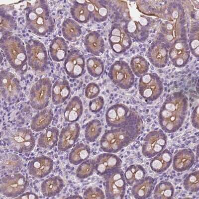 Immunohistochemistry-Paraffin: EPPK1 Antibody [NBP2-49597]