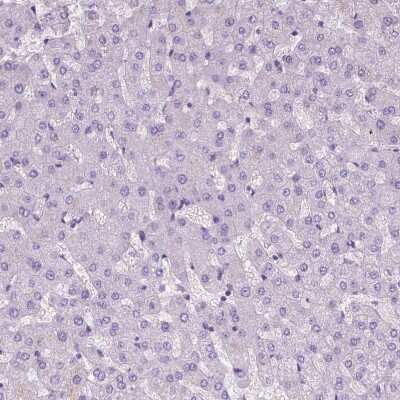 Immunohistochemistry-Paraffin: EPPK1 Antibody [NBP2-49597]