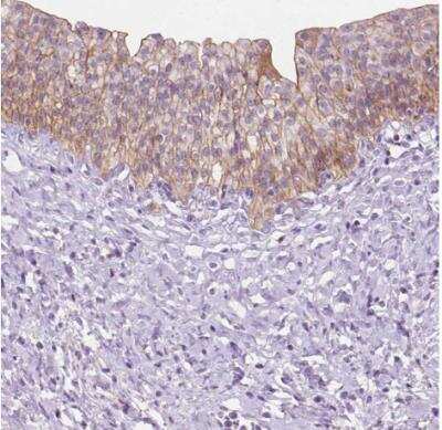 Immunohistochemistry-Paraffin: EPPK1 Antibody [NBP2-49597]