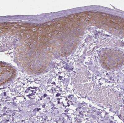 Immunohistochemistry-Paraffin: EPPK1 Antibody [NBP2-49597]