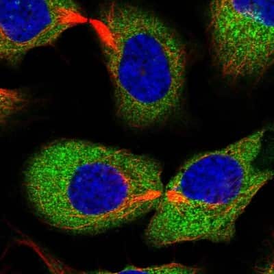 Immunocytochemistry/ Immunofluorescence: EPRS Antibody [NBP1-84929]
