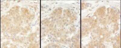Immunohistochemistry-Paraffin: EPRS Antibody [NBP2-22311]