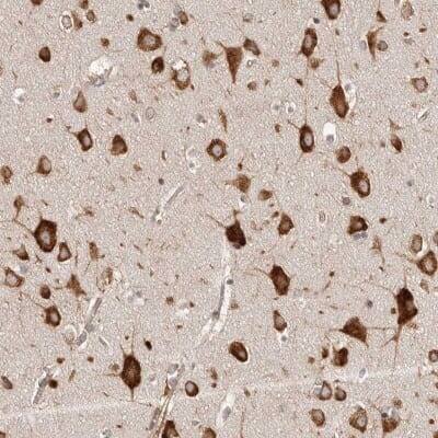 Immunohistochemistry-Paraffin: EPRS Antibody [NBP1-84929]