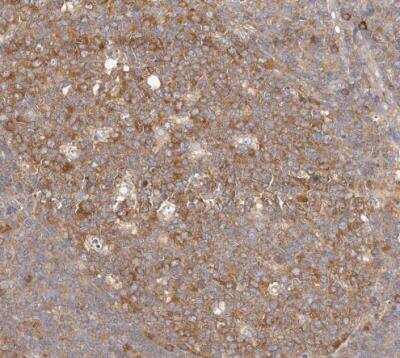 Immunohistochemistry-Paraffin: EPRS Antibody [NBP1-84929]