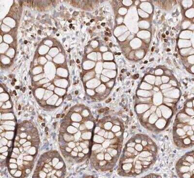 Immunohistochemistry-Paraffin: EPRS Antibody [NBP1-84929]