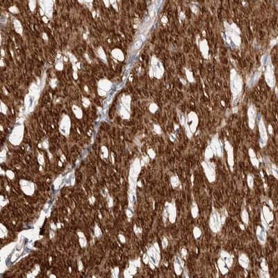 Immunohistochemistry-Paraffin: EPRS Antibody [NBP1-84930]