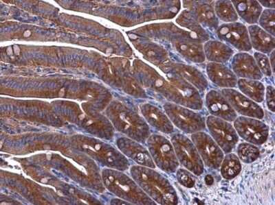 Immunohistochemistry-Paraffin: EPRS Antibody [NBP3-12962]