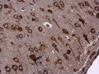 Immunohistochemistry-Paraffin: EPRS Antibody [NBP3-12962]