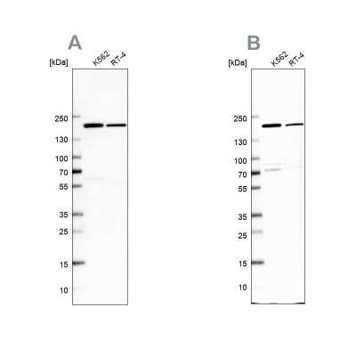 Western Blot: EPRS Antibody [NBP1-84929]