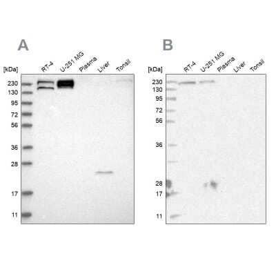 Western Blot: EPRS Antibody [NBP1-84930]