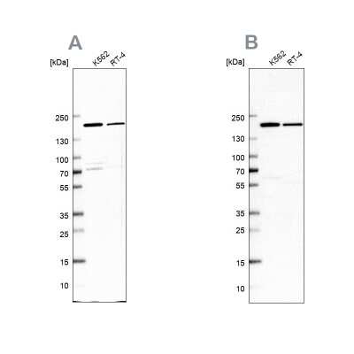 Western Blot: EPRS Antibody [NBP1-84930]