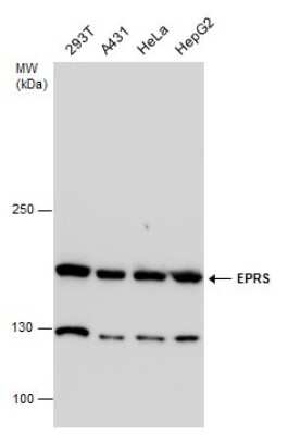 Western Blot: EPRS Antibody [NBP3-12962]