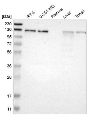 Western Blot: EPS15 Antibody [NBP1-89221]