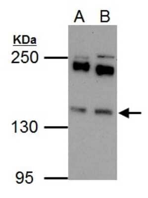 Western Blot: EPS15 Antibody [NBP2-16356]