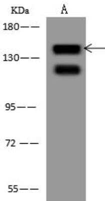 Western Blot: EPS15 Antibody [NBP3-12544]