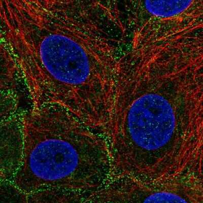 Immunocytochemistry/ Immunofluorescence: EPS15R Antibody [NBP2-56664]