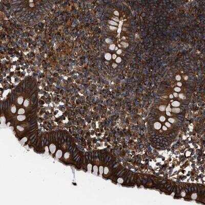 Immunohistochemistry-Paraffin: EPS15R Antibody [NBP1-84828]