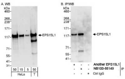 Western Blot: EPS15R Antibody [NB100-88149]