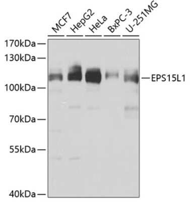 Western Blot: EPS15R AntibodyBSA Free [NBP3-03739]