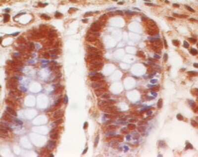 Immunohistochemistry-Paraffin: Eps8 Antibody (18F1F2) [NBP2-27300]