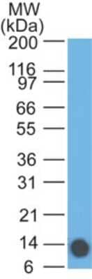 Western Blot: Eps8 Antibody (18F1F2) [NBP2-27300]