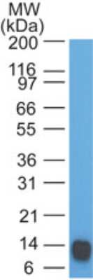 Western Blot: Eps8 Antibody (18F5B11) [NBP2-27344]