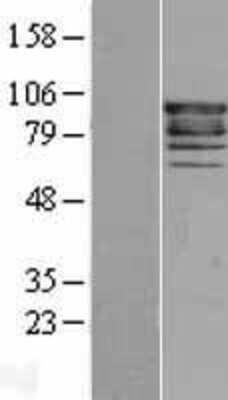 Western Blot: Eps8 Overexpression Lysate [NBL1-10303]