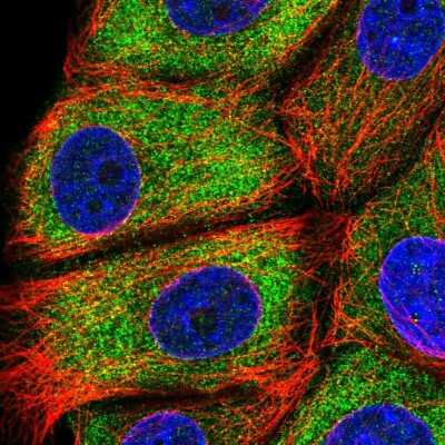 Immunocytochemistry/ Immunofluorescence: EPS8L1 Antibody [NBP2-33288]