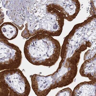 Immunohistochemistry: EPS8L1 Antibody [NBP2-33288]