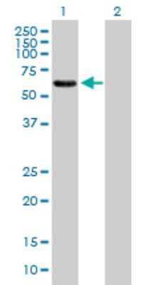 Western Blot: EPS8L1 Antibody [H00054869-B01P]