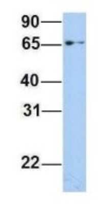 Western Blot: EPS8L1 Antibody [NBP1-56615]