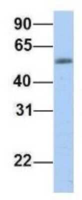 Western Blot: EPS8L1 Antibody [NBP1-56615]