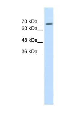 Western Blot: EPS8L1 Antibody [NBP1-56689]