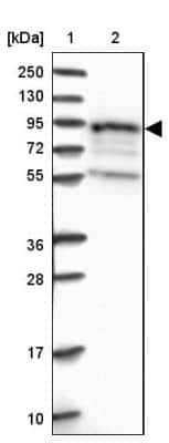 Western Blot: EPS8L1 Antibody [NBP2-32599]