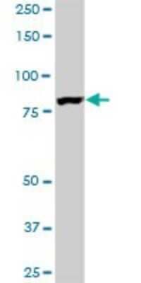 Western Blot: EPS8L2 Antibody (6C2) [H00064787-M01]