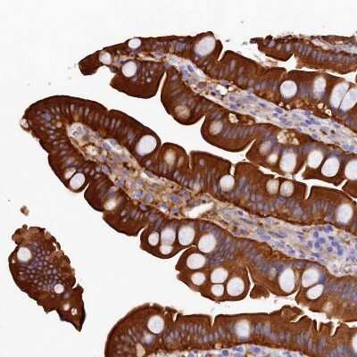 Immunohistochemistry-Paraffin: EPS8L2 Antibody [NBP1-83613]
