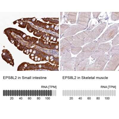 Immunohistochemistry-Paraffin: EPS8L2 Antibody [NBP1-83613]