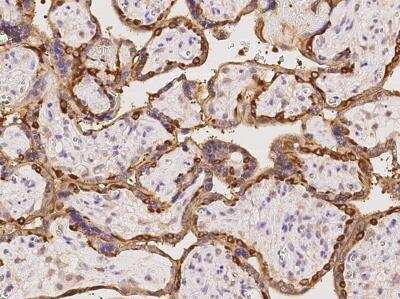 Immunohistochemistry-Paraffin: EPS8L2 Antibody [NBP3-06508]